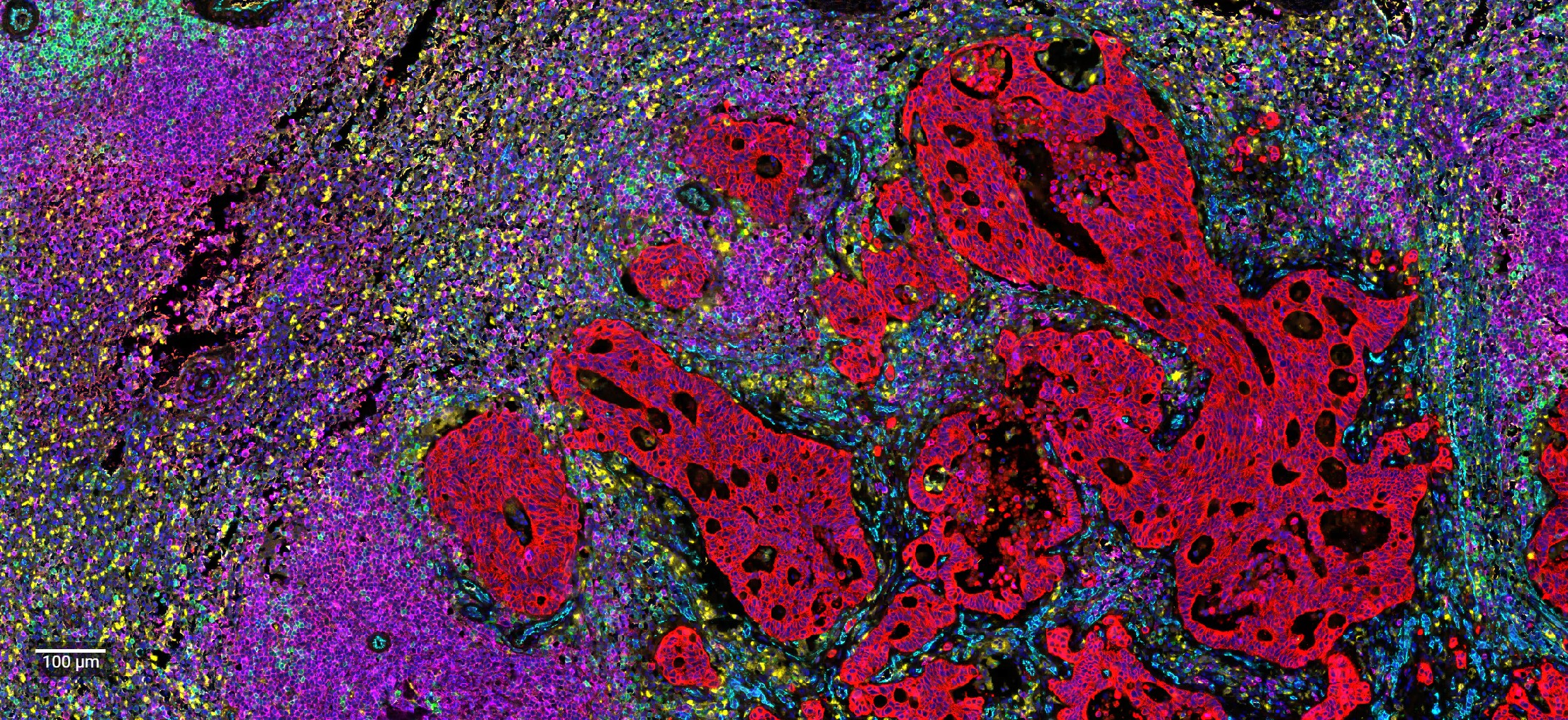 Immunofluorescence tissue specimen
