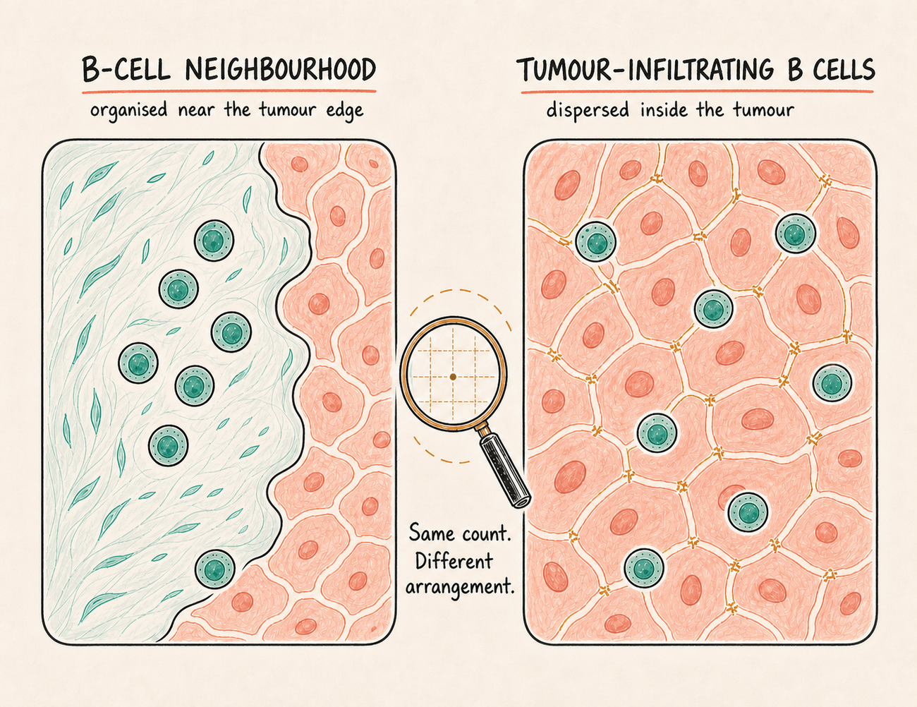Same B-cell count, different arrangement: organized near the tumor edge versus dispersed inside it.