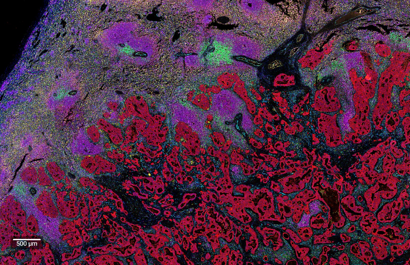 Multiplex immunofluorescence tissue section